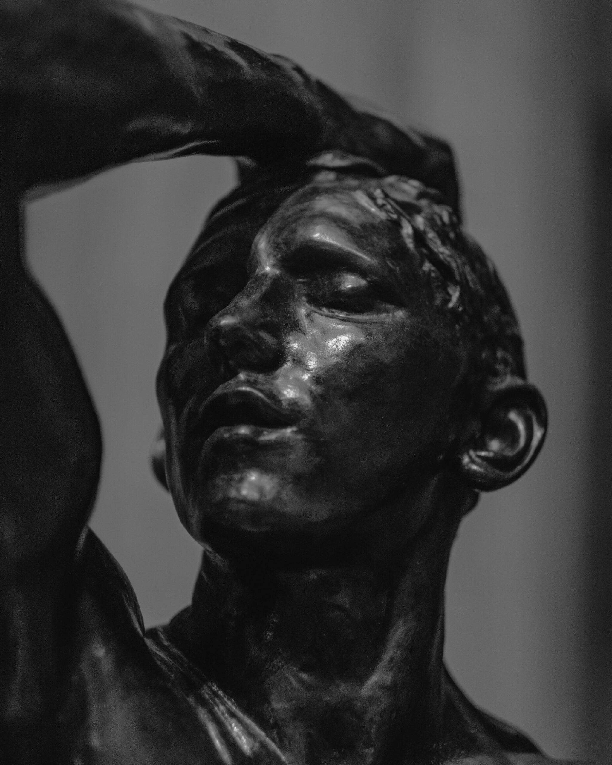 Man clasping his head. Brain Fog.